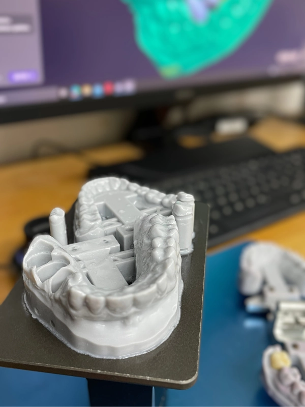 Dentallabor Hamburg-Zimbelmann-Zahntechnik - 3D-Druck